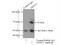 DEAD-Box Helicase 17 antibody, 19910-1-AP, Proteintech Group, Immunoprecipitation image 