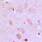 Isoleucyl-TRNA Synthetase 2, Mitochondrial antibody, LS-C353486, Lifespan Biosciences, Immunohistochemistry paraffin image 