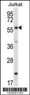 Forkhead Box J3 antibody, 57-006, ProSci, Western Blot image 