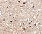 Junctophilin 3 antibody, A08160, Boster Biological Technology, Immunohistochemistry paraffin image 