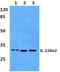 Interleukin 22 Receptor Subunit Alpha 2 antibody, A06250, Boster Biological Technology, Western Blot image 