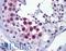 Cyclin Dependent Kinase 1 antibody, LS-B6130, Lifespan Biosciences, Immunohistochemistry paraffin image 
