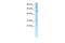 Zinc Finger Protein 500 antibody, A15421, Boster Biological Technology, Western Blot image 