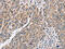 Protein Phosphatase 1 Catalytic Subunit Gamma antibody, CSB-PA188909, Cusabio, Immunohistochemistry paraffin image 