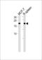 CCHC-Type Zinc Finger Nucleic Acid Binding Protein antibody, 60-967, ProSci, Western Blot image 