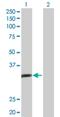 AlkB Homolog 3, Alpha-Ketoglutaratedependent Dioxygenase antibody, H00221120-D01P, Novus Biologicals, Western Blot image 