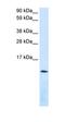 C-X-C Motif Chemokine Ligand 12 antibody, orb333745, Biorbyt, Western Blot image 