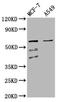 Solute Carrier Family 22 Member 5 antibody, LS-C681354, Lifespan Biosciences, Western Blot image 