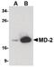 Lymphocyte Antigen 96 antibody, MA5-15765, Invitrogen Antibodies, Western Blot image 