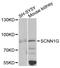 Sodium Channel Epithelial 1 Gamma Subunit antibody, STJ27879, St John