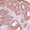 HRas Proto-Oncogene, GTPase antibody, orb73741, Biorbyt, Immunohistochemistry paraffin image 