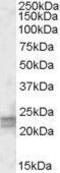 ADP Ribosylation Factor Like GTPase 4D antibody, GTX88455, GeneTex, Western Blot image 