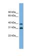 Crystallin Mu antibody, orb325711, Biorbyt, Western Blot image 