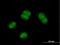 Nucleic Acid Binding Protein 2 antibody, H00079035-B01P, Novus Biologicals, Immunocytochemistry image 
