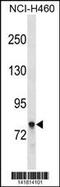 Amphiphysin antibody, 60-782, ProSci, Western Blot image 