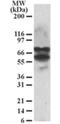 Protein Phosphatase 2 Regulatory Subunit B'Delta antibody, NB100-846, Novus Biologicals, Western Blot image 