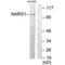 N(Alpha)-Acetyltransferase 15, NatA Auxiliary Subunit antibody, PA5-49874, Invitrogen Antibodies, Western Blot image 