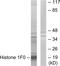 H1 Histone Family Member 0 antibody, LS-C118760, Lifespan Biosciences, Western Blot image 