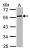 Ornithine Decarboxylase 1 antibody, PA5-21362, Invitrogen Antibodies, Western Blot image 