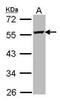 Ornithine Decarboxylase 1 antibody, PA5-21362, Invitrogen Antibodies, Western Blot image 