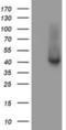 Tubulin-specific chaperone C antibody, NBP2-02037, Novus Biologicals, Western Blot image 