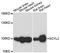 SCY1 Like Pseudokinase 2 antibody, LS-C748239, Lifespan Biosciences, Western Blot image 