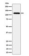 Ubiquitination Factor E4A antibody, M11871, Boster Biological Technology, Western Blot image 