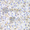 Hydroxyacid Oxidase 1 antibody, A6470, ABclonal Technology, Immunohistochemistry paraffin image 