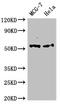 Protein Tyrosine Kinase 6 antibody, orb51542, Biorbyt, Western Blot image 