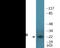 BCL2 Associated Agonist Of Cell Death antibody, EKC2216, Boster Biological Technology, Western Blot image 