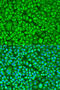 Tubulin Beta 8 Class VIII antibody, 23-553, ProSci, Immunofluorescence image 