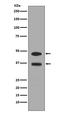 FosB Proto-Oncogene, AP-1 Transcription Factor Subunit antibody, M01569, Boster Biological Technology, Western Blot image 