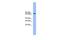 Ubiquitin Specific Peptidase 1 antibody, PA5-44962, Invitrogen Antibodies, Western Blot image 