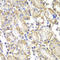LYN Proto-Oncogene, Src Family Tyrosine Kinase antibody, LS-C331886, Lifespan Biosciences, Immunohistochemistry paraffin image 