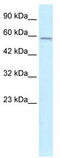 Transmembrane Protein 175 antibody, TA335429, Origene, Western Blot image 