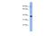 Olfactory Receptor Family 2 Subfamily L Member 8 (Gene/Pseudogene) antibody, A18765, Boster Biological Technology, Western Blot image 