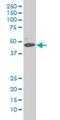 Mitogen-Activated Protein Kinase 1 antibody, H00005594-M01, Novus Biologicals, Western Blot image 