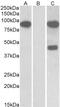 NUMB Like Endocytic Adaptor Protein antibody, 43-109, ProSci, Western Blot image 