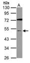 Gamma-Aminobutyric Acid Type A Receptor Alpha5 Subunit antibody, NBP2-16567, Novus Biologicals, Western Blot image 