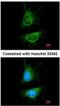 MDM2 Proto-Oncogene antibody, NBP2-17247, Novus Biologicals, Immunocytochemistry image 