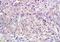 Natural Cytotoxicity Triggering Receptor 2 antibody, GTX37443, GeneTex, Immunohistochemistry paraffin image 