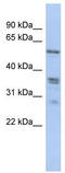 Solute Carrier Family 38 Member 2 antibody, TA331844, Origene, Western Blot image 