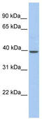 Serine Protease 54 antibody, TA334988, Origene, Western Blot image 