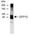 Dipeptidyl Peptidase Like 10 antibody, PA1-46143, Invitrogen Antibodies, Western Blot image 