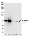 Signal Recognition Particle 72 antibody, A304-594A, Bethyl Labs, Western Blot image 