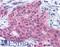 Matrix Metallopeptidase 13 antibody, LS-A1554, Lifespan Biosciences, Immunohistochemistry paraffin image 