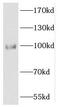 Dachshund homolog 1 antibody, FNab02230, FineTest, Western Blot image 