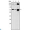 ATPase Secretory Pathway Ca2+ Transporting 1 antibody, LS-C812833, Lifespan Biosciences, Immunohistochemistry paraffin image 