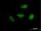 Nucleolar Protein 6 antibody, H00065083-B01P, Novus Biologicals, Immunocytochemistry image 