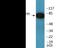 MRE11 Homolog, Double Strand Break Repair Nuclease antibody, EKC2334, Boster Biological Technology, Western Blot image 